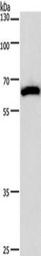 Calcium/Calmodulin Dependent Protein Kinase IV antibody, TA349738, Origene, Western Blot image 