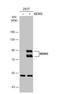 MDM2 Proto-Oncogene antibody, NBP2-17247, Novus Biologicals, Western Blot image 