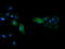 Mitogen-Activated Protein Kinase 13 antibody, LS-C797670, Lifespan Biosciences, Immunofluorescence image 