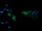 p38 MAPK antibody, LS-C797670, Lifespan Biosciences, Immunofluorescence image 