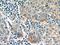 Putative protein TIGA1 antibody, 24698-1-AP, Proteintech Group, Immunohistochemistry paraffin image 