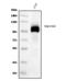 Integrin Subunit Beta 5 antibody, M04201, Boster Biological Technology, Western Blot image 