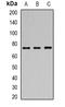 SAM And HD Domain Containing Deoxynucleoside Triphosphate Triphosphohydrolase 1 antibody, orb382025, Biorbyt, Western Blot image 