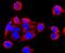 Matrix Metallopeptidase 13 antibody, NBP2-66954, Novus Biologicals, Immunofluorescence image 