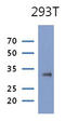 Ribose-phosphate pyrophosphokinase 1 antibody, LS-C200862, Lifespan Biosciences, Western Blot image 