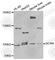 Aggrecan antibody, A8536, ABclonal Technology, Western Blot image 