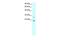 Claudin 9 antibody, GTX77838, GeneTex, Western Blot image 