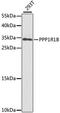 Protein Phosphatase 1 Regulatory Inhibitor Subunit 1B antibody, A2580, ABclonal Technology, Western Blot image 