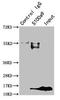 S100 Calcium Binding Protein A9 antibody, LS-C319039, Lifespan Biosciences, Immunoprecipitation image 