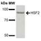 Heat Shock Transcription Factor 2 antibody, PA5-77831, Invitrogen Antibodies, Western Blot image 