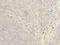 Peptidylprolyl Isomerase H antibody, A60374-100, Epigentek, Immunohistochemistry paraffin image 