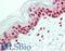 Protein Phosphatase 2 Regulatory Subunit Balpha antibody, LS-B15680, Lifespan Biosciences, Immunohistochemistry paraffin image 