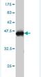 Stanniocalcin 1 antibody, H00006781-M01, Novus Biologicals, Western Blot image 