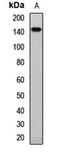 ATP Binding Cassette Subfamily B Member 1 antibody, LS-C667909, Lifespan Biosciences, Western Blot image 