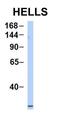 Helicase, Lymphoid Specific antibody, orb329871, Biorbyt, Western Blot image 