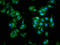 GABA Type A Receptor-Associated Protein antibody, LS-C211702, Lifespan Biosciences, Immunofluorescence image 