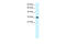 E2F Transcription Factor 5 antibody, P100920_P050, Aviva Systems Biology, Western Blot image 