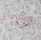 Procollagen-Lysine,2-Oxoglutarate 5-Dioxygenase 3 antibody, FNab06553, FineTest, Immunohistochemistry paraffin image 