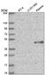 ELOVL Fatty Acid Elongase 5 antibody, NBP2-58784, Novus Biologicals, Western Blot image 