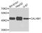 Calcium homeostasis modulator protein 1 antibody, A7858, ABclonal Technology, Western Blot image 