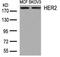 ERBB2 antibody, 79-309, ProSci, Western Blot image 