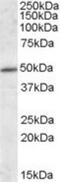 Intraflagellar Transport 57 antibody, NBP1-28913, Novus Biologicals, Western Blot image 