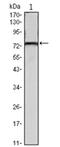 Kelch Like Family Member 22 antibody, AM06521SU-N, Origene, Western Blot image 