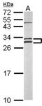 Nitric Oxide Synthase Interacting Protein antibody, NBP2-19566, Novus Biologicals, Western Blot image 