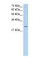 Fatty Acid Hydroxylase Domain Containing 2 antibody, NBP1-60125, Novus Biologicals, Western Blot image 