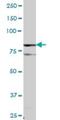 Diacylglycerol Kinase Alpha antibody, H00001606-B01P, Novus Biologicals, Western Blot image 