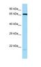 Heat shock 70 kDa protein 1A/1B antibody, NBP1-98547, Novus Biologicals, Western Blot image 