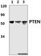 Phosphatase And Tensin Homolog antibody, A00006-2, Boster Biological Technology, Western Blot image 