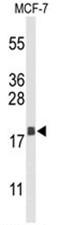 Anterior Gradient 3, Protein Disulphide Isomerase Family Member antibody, AP50114PU-N, Origene, Western Blot image 