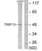 Thyroid Hormone Receptor Interactor 13 antibody, EKC1825, Boster Biological Technology, Western Blot image 