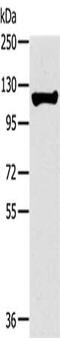 Telomerase Reverse Transcriptase antibody, CSB-PA912041, Cusabio, Western Blot image 