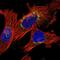 BRI antibody, NBP1-88354, Novus Biologicals, Immunofluorescence image 