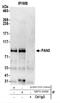 Poly(A) Specific Ribonuclease Subunit PAN3 antibody, NBP2-44286, Novus Biologicals, Western Blot image 