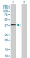 ACK1 antibody, H00010188-D01P, Novus Biologicals, Western Blot image 