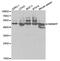 Heterogeneous Nuclear Ribonucleoprotein F antibody, PA5-76435, Invitrogen Antibodies, Western Blot image 