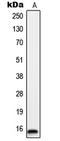 LTO1 Maturation Factor Of ABCE1 antibody, LS-B12972, Lifespan Biosciences, Western Blot image 