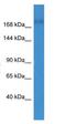 Rho GTPase Activating Protein 35 antibody, NBP1-80051, Novus Biologicals, Western Blot image 