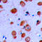 Ret Proto-Oncogene antibody, LS-C358278, Lifespan Biosciences, Immunohistochemistry paraffin image 