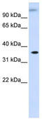 Dihydrodiol Dehydrogenase antibody, TA334542, Origene, Western Blot image 