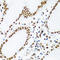 KH RNA Binding Domain Containing, Signal Transduction Associated 1 antibody, A01717, Boster Biological Technology, Immunohistochemistry paraffin image 