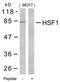 Heat Shock Transcription Factor 1 antibody, 79-385, ProSci, Western Blot image 