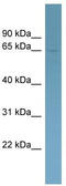 Homeobox And Leucine Zipper Encoding antibody, TA342469, Origene, Western Blot image 