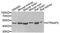 ATPase H+ Transporting Accessory Protein 2 antibody, abx005010, Abbexa, Western Blot image 