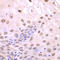 Sequestosome 1 antibody, LS-C746989, Lifespan Biosciences, Immunohistochemistry frozen image 