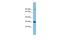 Chromatin Target Of PRMT1 antibody, A07770, Boster Biological Technology, Western Blot image 