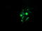 Galactosidase Beta 1 antibody, LS-B9826, Lifespan Biosciences, Immunofluorescence image 